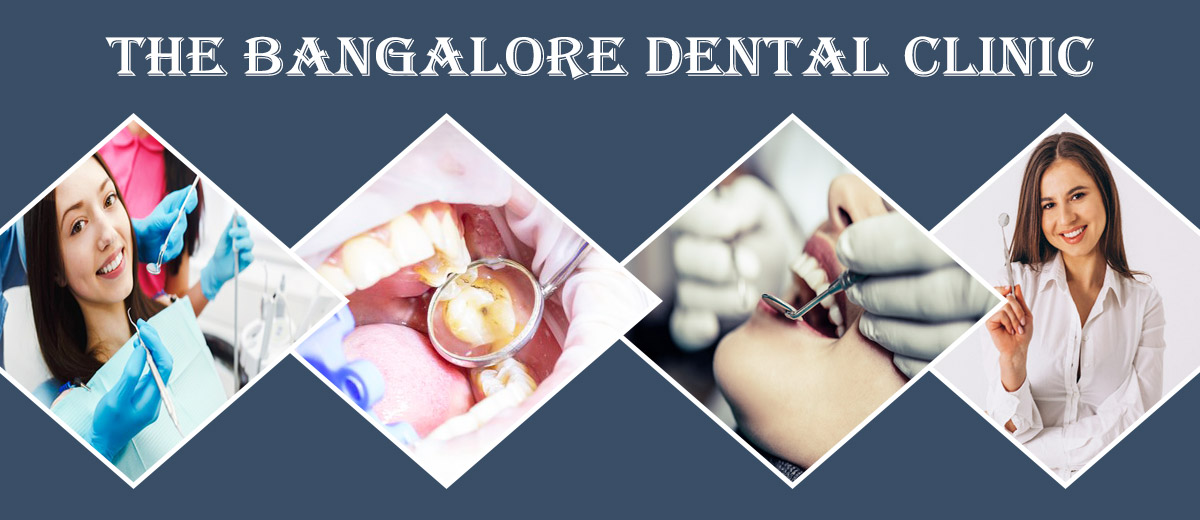 Best Dental Clinic in Bangalore | Dental Clinic in Bangalore