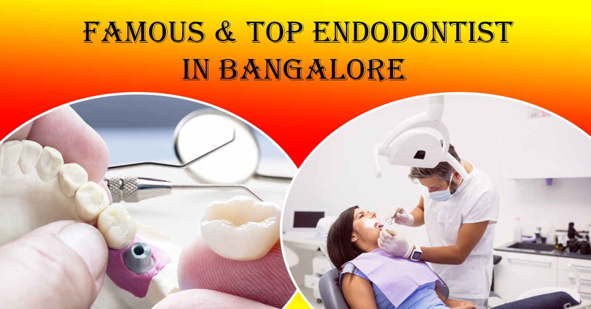 Best Endodontist in Bangalore | Endodontist in Bangalore