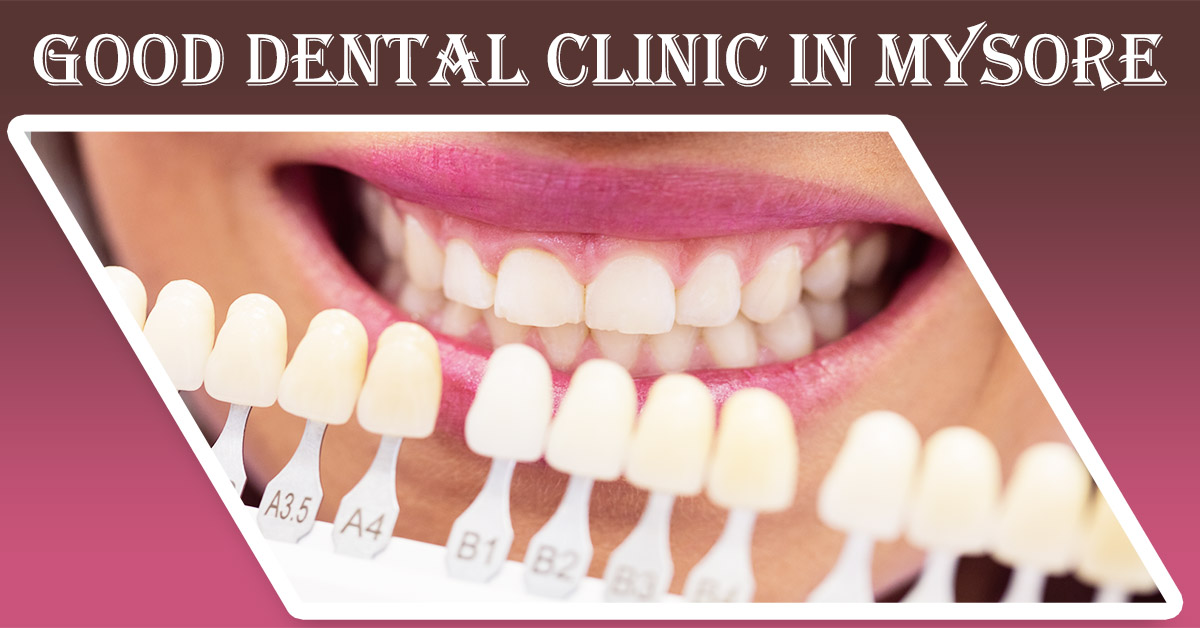 Best Dental Clinic in Mysore | Dental Clinic in Mysore