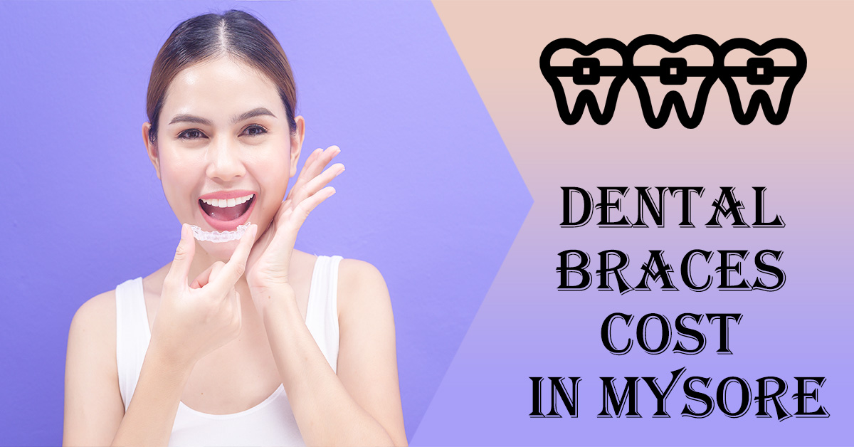 Best Dentist for Braces in Mysore | Best Dental Clinic