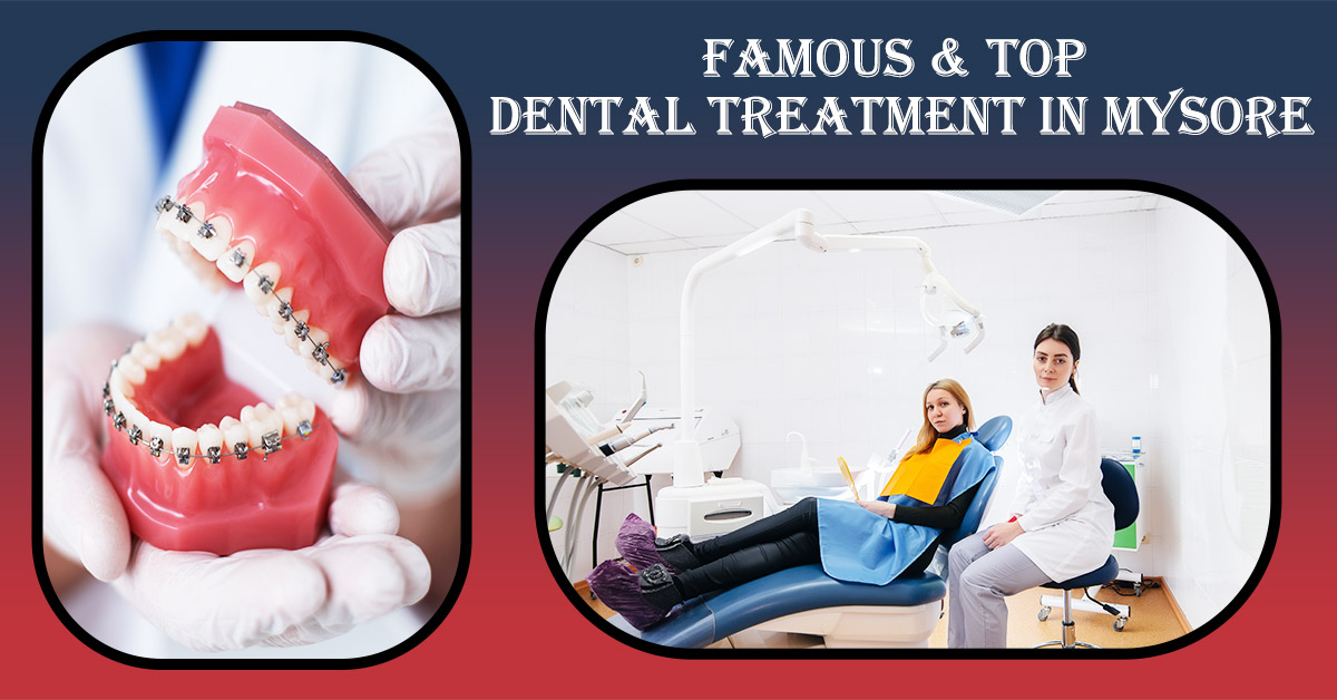 Best Dental Treatment in Mysore | Dental Treatment in Mysore