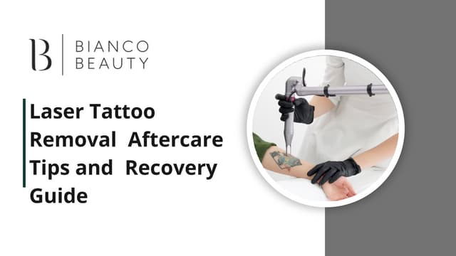 Laser Tattoo Removal Aftercare Tips and Recovery Guide | PPT