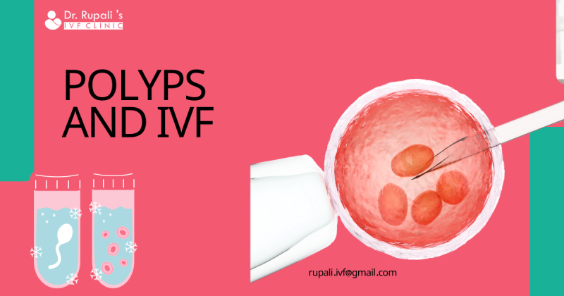 Polyps and IVF: ext_6602037 — LiveJournal