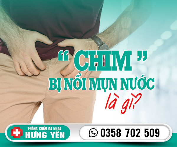 Chim bị nổi mụn nước: Nguyên nhân, tác hại và cách điều trị