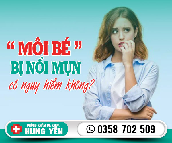 Môi bé bị nổi mụn có sao không?