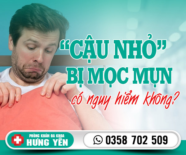 Cậu nhỏ bị mọc mụn có phải dấu hiệu nguy hiểm?