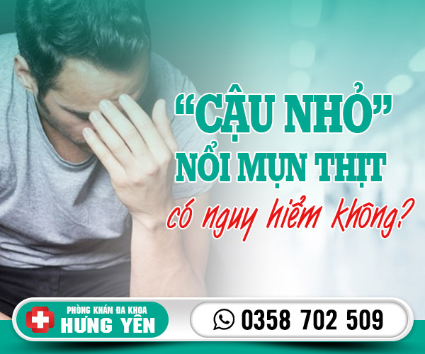 Cậu nhỏ nổi mụn thịt có sao không?