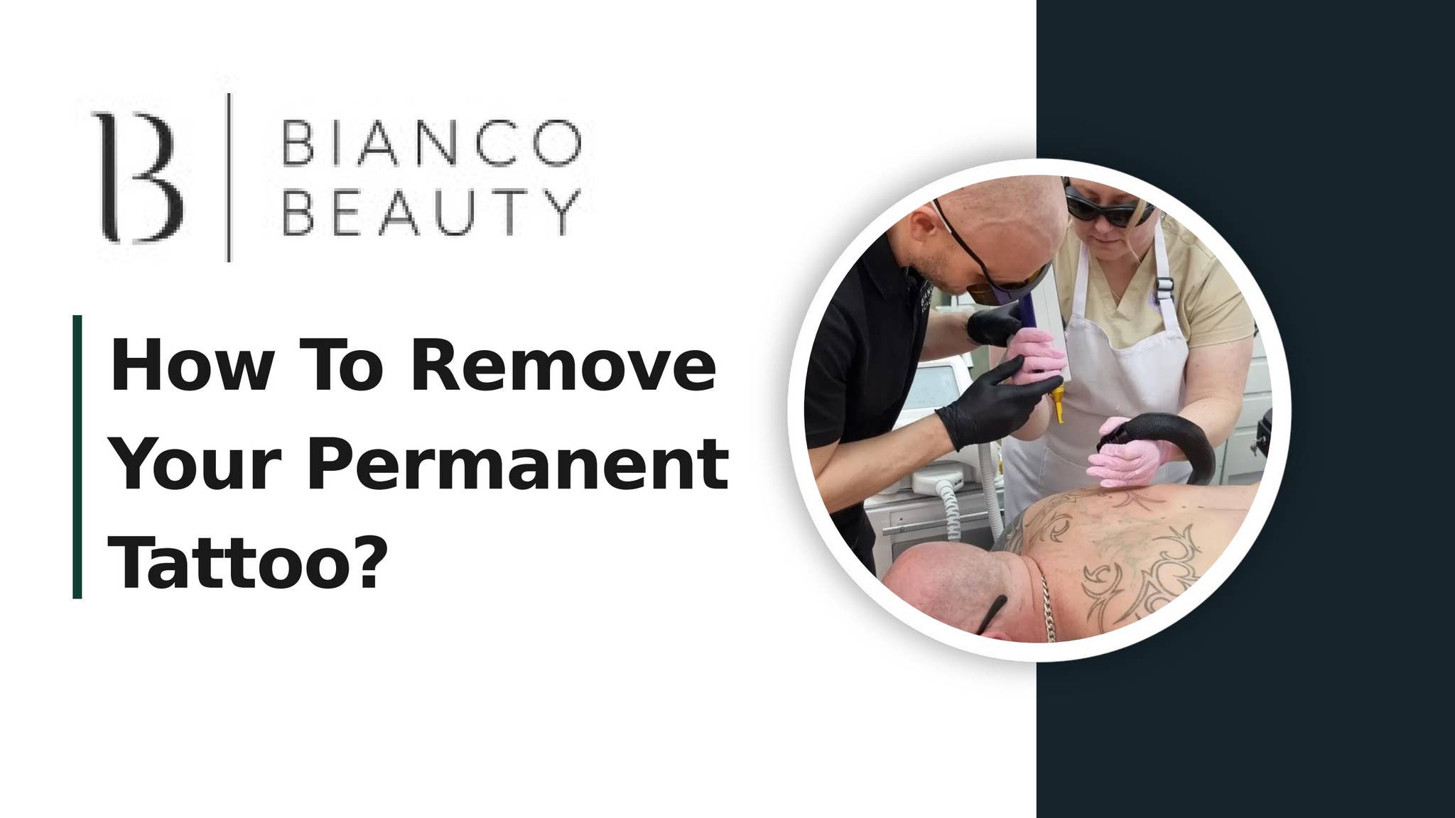 How To Remove Your Permanent Tattoo?