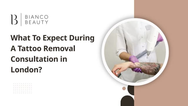 What To Expect During A Tattoo Removal Consultation in London? | PPT