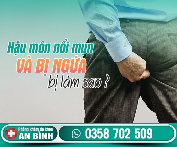 Hậu môn nổi mụn và ngứa bị làm sao? Có nguy hiểm không?