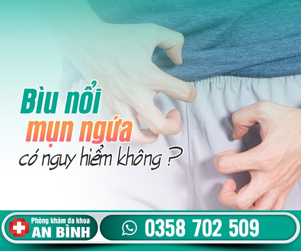 Bìu nổi mụn ngứa bị làm sao? Có nguy hiểm không?