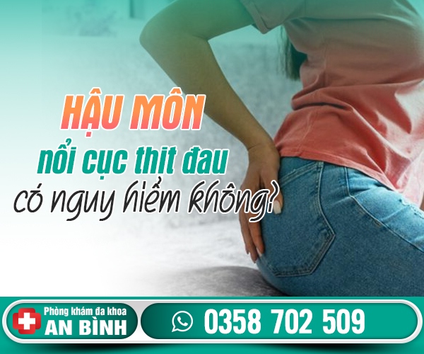 Hậu môn nổi cục thịt đau bị làm sao?