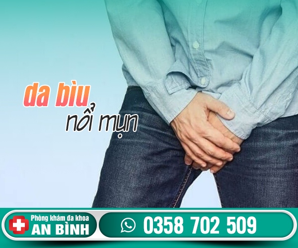 Da bìu nổi mụn bị làm sao? Có nguy hiểm không?