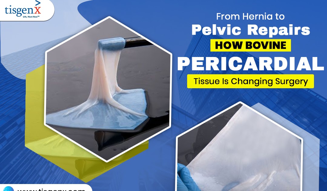 From Hernia to Pelvic Repairs: How Bovine Pericardial Tissue Is Changing Surgery