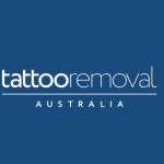 Tattoo Removal Australia