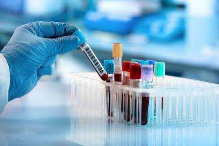 Trusted Diagnostic Labs in Panchkula for All Your Test Needs